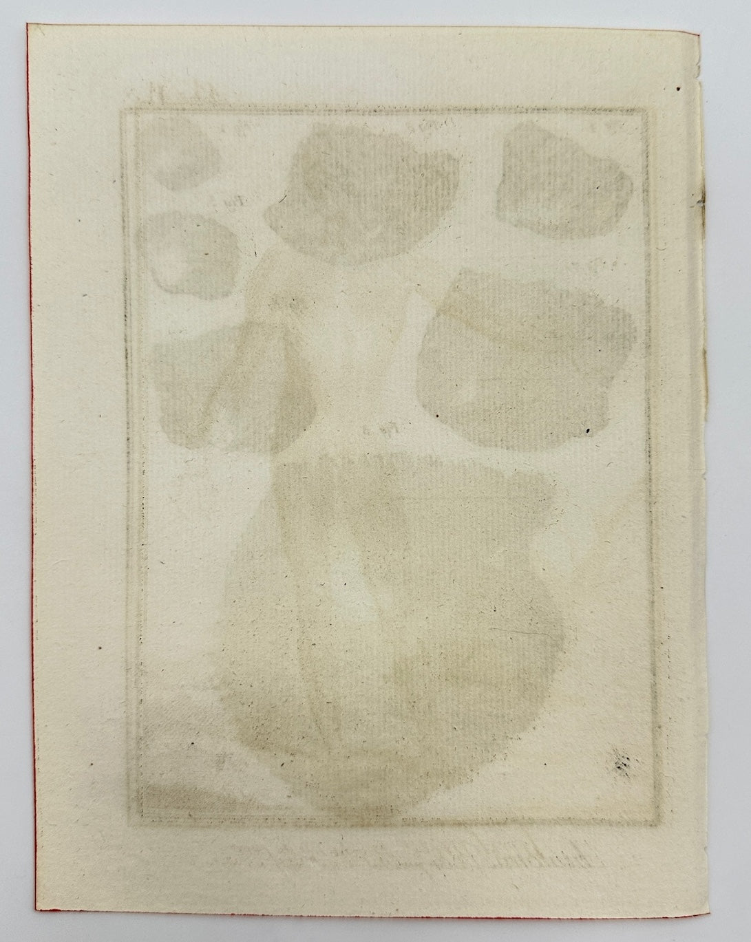 Antique Print - Jacques Renaud Bernard - Parietal Bone in Different States - C2