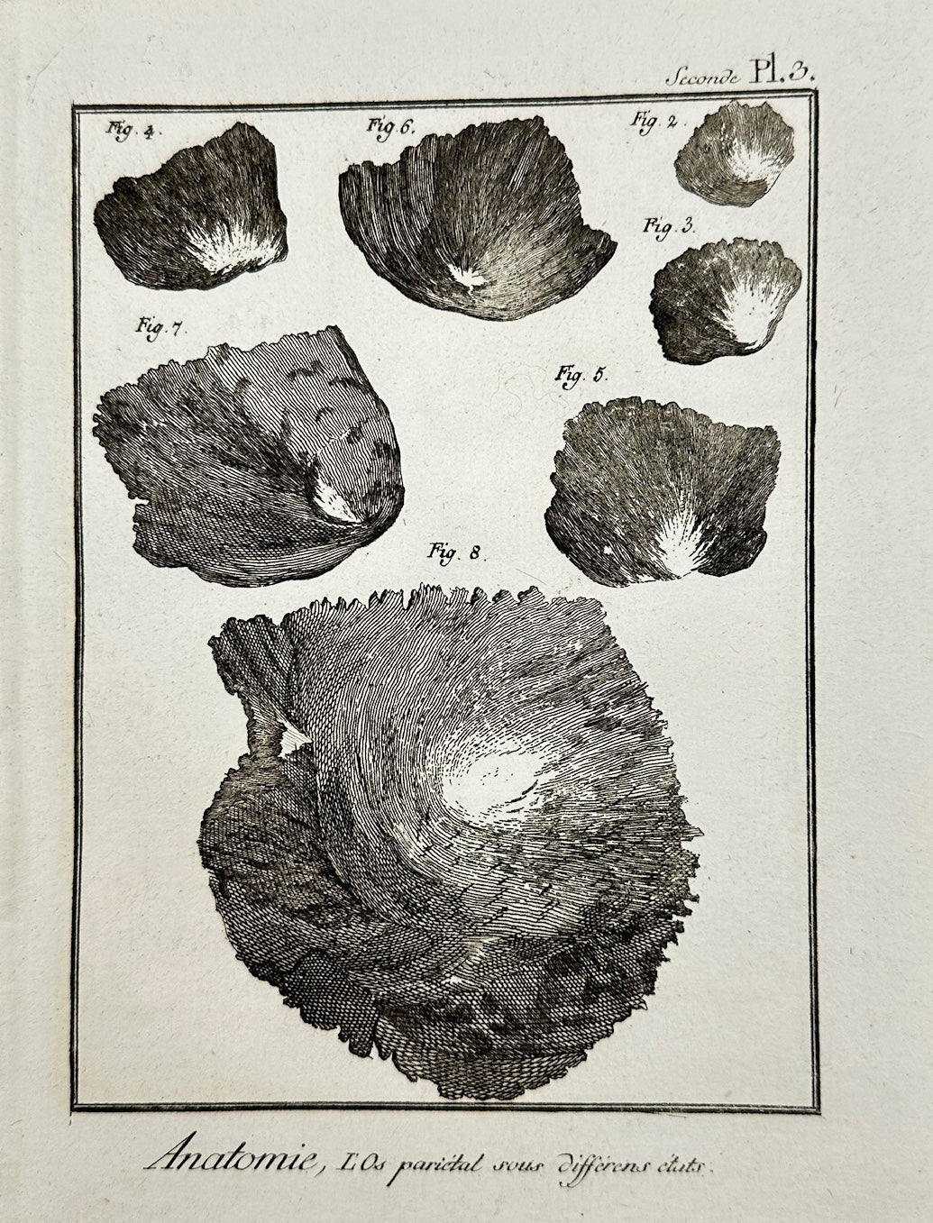 Antique Print - Jacques Renaud Bernard - Parietal Bone in Different States - C2